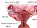 Léčba endometrioidní ovariální cysty Endometrioidní ovariální cysta