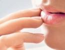 Kokia liga gali būti baltos lūpos skausmo priežastis ir kaip ją gydyti
