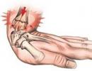 Zapobieganie bólom nadgarstków