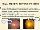Obnova zrakového nervu - očami novinárov a špecialistov