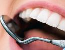 Ce este restaurarea artistică a dinților sau cum să respirați viața nouă într-un zâmbet Restaurarea unui dinte anterior cum se face